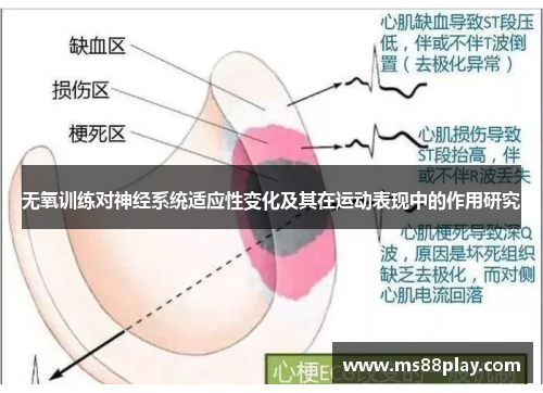 无氧训练对神经系统适应性变化及其在运动表现中的作用研究